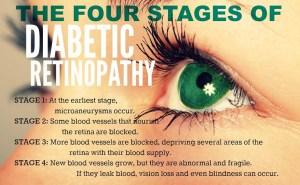 stages-of-diabetic-retinopathy